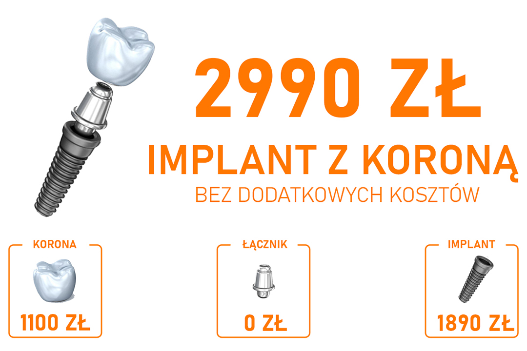 Implant z Koroną 2990 zł Promocja Wołomin